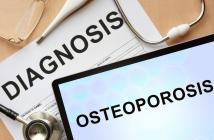 diagnosis osteoporosis