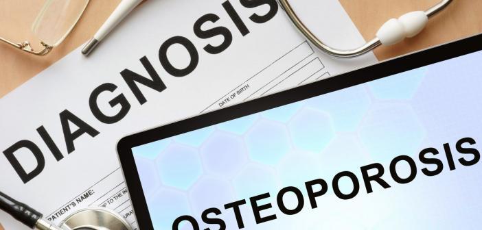 diagnosis osteoporosis